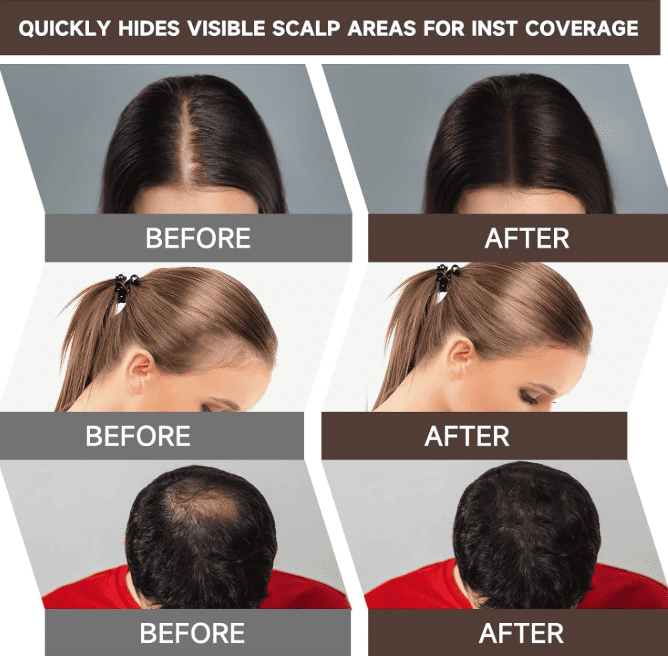 Bunee®️ Cobertura profesional para canas y calvicie en un solo toque ¡AHORA CON DOBLE CONTENIDO!✨🤩
