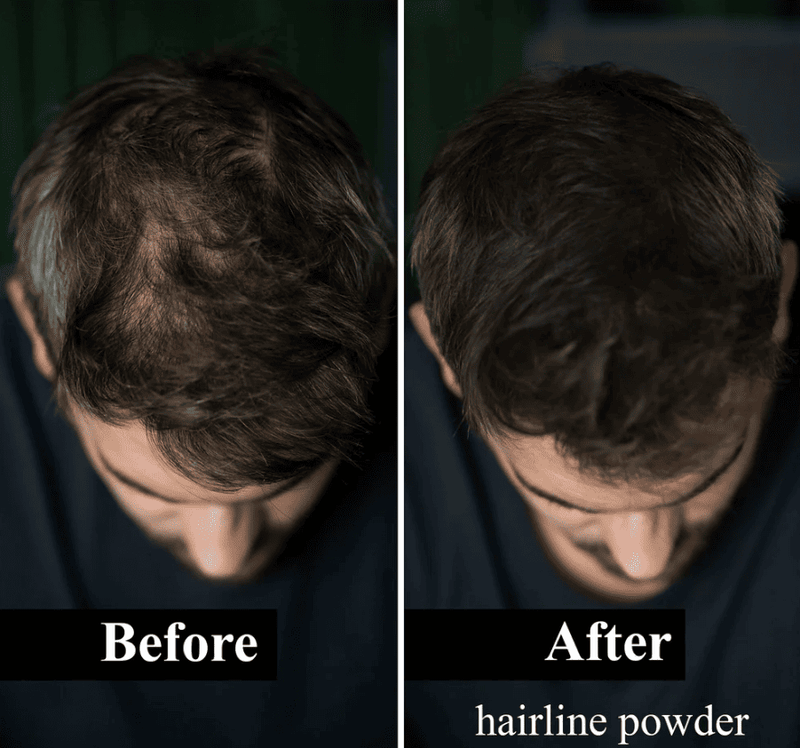 Bunee®️ Cobertura profesional para canas y calvicie en un solo toque ¡AHORA CON DOBLE CONTENIDO!✨🤩