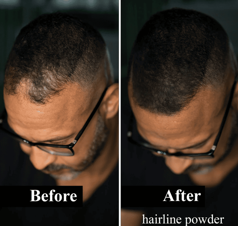 Bunee®️ Cobertura profesional para canas y calvicie en un solo toque ¡AHORA CON DOBLE CONTENIDO!✨🤩