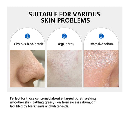 Zero Pore Pad 2.0 Double Textured Facial Toner For Exfoliating And Smoothing Pores Korean Skin Care Pad For All Skin Types 70pcs